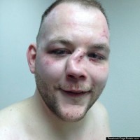 Really great reason to NOT be an MMA fighter