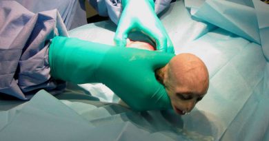 Baby Monkey was born in c section